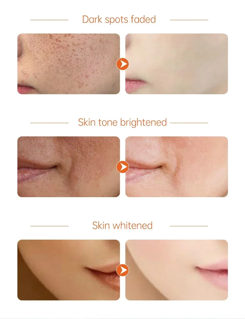 White Rice Face Whitening Cream