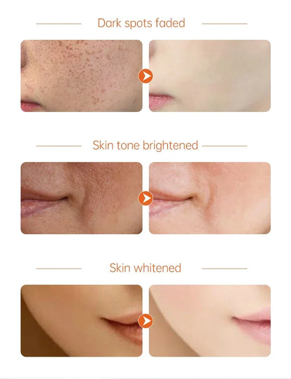 White Rice Face Whitening Cream