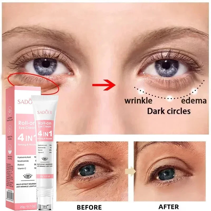 Instant Eye Bag Removal Cream