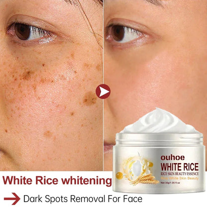 White Rice Face Whitening Cream