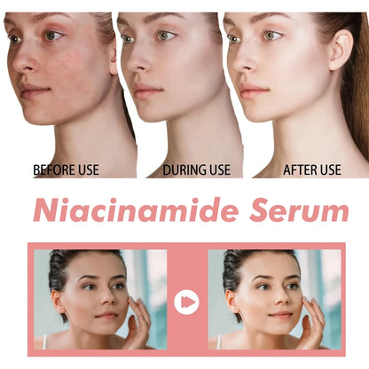 Niacinamide Whitening Serum