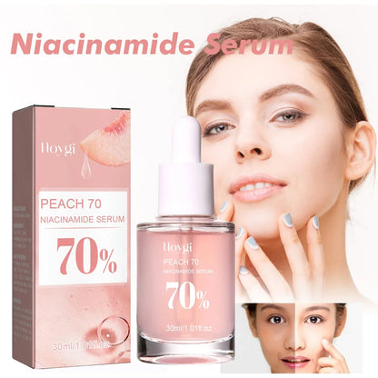 Niacinamide Whitening Serum