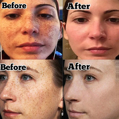 Niacinamide Whitening Serum